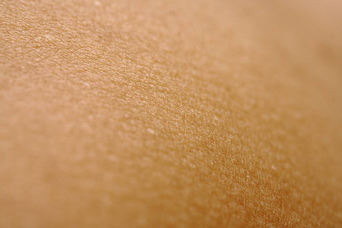 Before and after photos showing reduced redness and flakiness in dry skin after switching to hydrating shaving gel